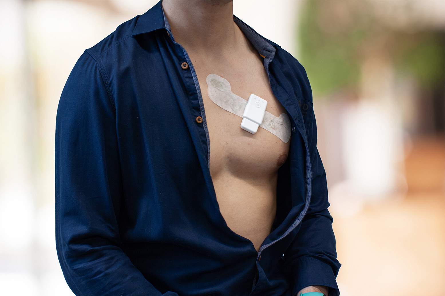 End-to-end sensor product development

From complex sensor concept to certified, production-ready product.

2M Engineering takes technical ownership of hardware, embedded software, algorithms, certification and industrialization for medical, wearable and industrial sensing products.